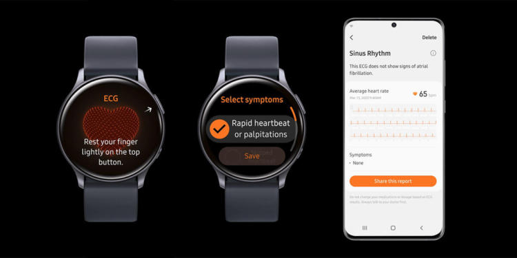 Samsung Elctronics' new ECG function for the Galaxy Watch Active 2.