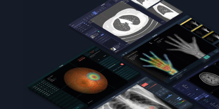 Startups are tackling areas ranging from diagnostics to data analysis as artificial intelligence (AI) has become more relevant across healthcare systems.