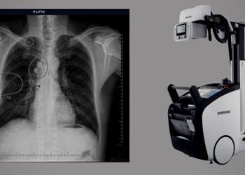 VUNO Signs Another Deal with Samsung Electronics