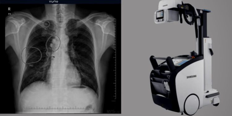 VUNO Signs Another Deal with Samsung Electronics